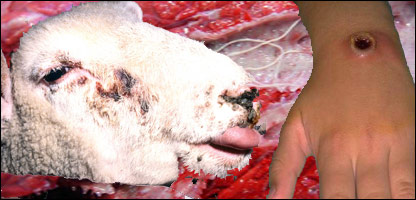 د ټک ناروغي