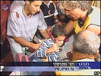 Eilat'ta bir hastanedeki yaralılar