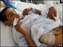 Menino ferido por bomba de fragmentação no Líbano