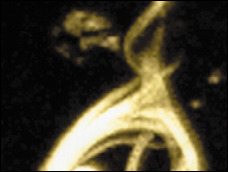 This is the human Tau protein