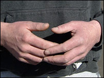 hands
