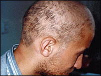 вражений талієм