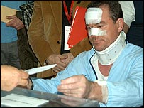 विस्फोट में घायल लोगों ने भी मतदान में बढ़-चढ़कर हिस्सा लिया