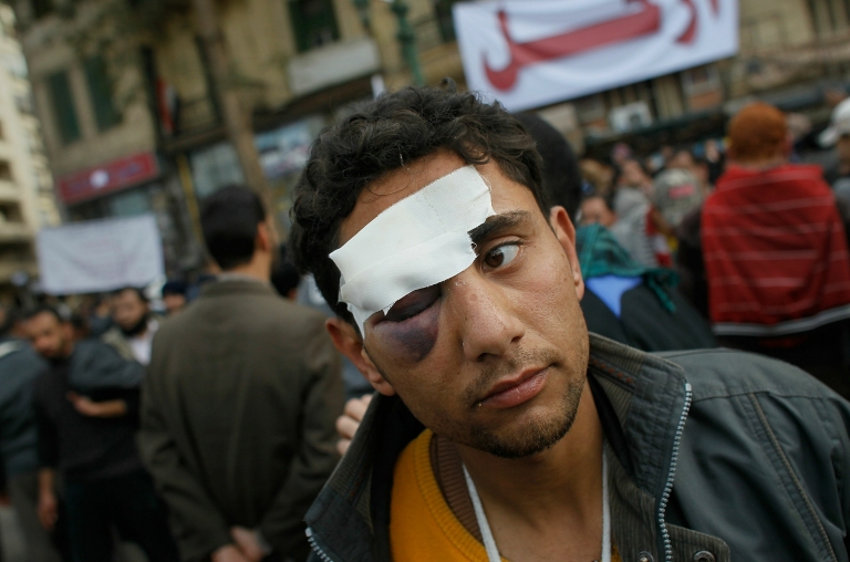 Man injured in Tahrir Square - Chris Hondros/Getty Image