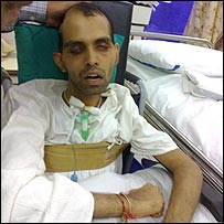 अमित सिंह