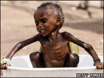 Criança desnutrida no Quênia