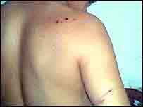 پسند کی شادی کی سزا