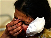 يکی از مجروحان انفجار محموديه