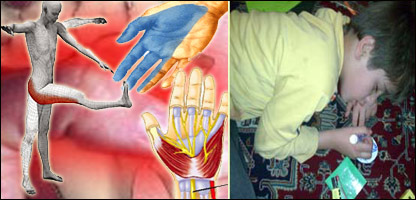 کرختی دست و پا