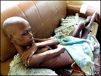 Garoto com AIDS na Africa