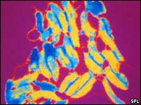 Bakterie vibrio cholerae, která způsobuje choleru
