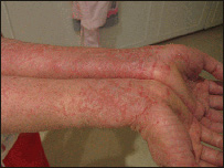 دپوستکي چاودل