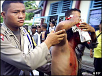 Papua'daki eylemde yaralanan bir polis