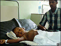 Hastanede yatan çocuk (arşiv)