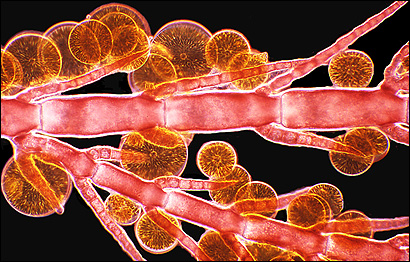 Arlene Wechezak, Anacortes, Washington, Estados Unidos (Foto: Cortesia do Concurso Nikon Small World)