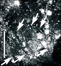 Abdómen de piolho fossilizado
