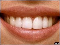 सुंदर दाँत