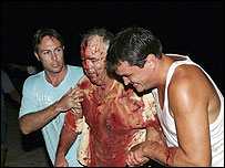  بالی دھماکہ 