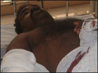 Injured person in Batticaloa Hospital