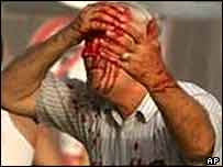 انفجار حسينيه شيعيان