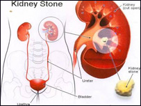 دتشومتيازوبندېدل