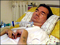 Paciente italiano Piergiorgio Welby