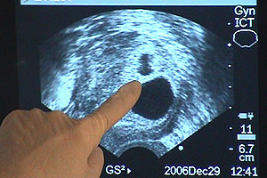 For most people adding to a family is a wonderful time, but for Anna it's been filled with anguish. 