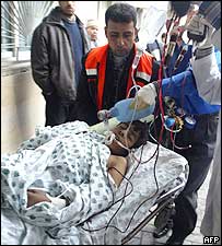 Saldırıda yaralanan Filistinli bir çocuk