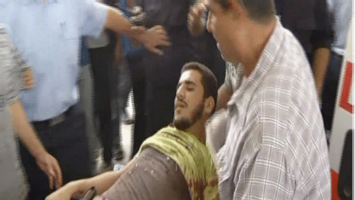 اسرائیلی حملے میں زخمی فلسطینی