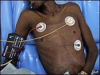 Afrikalı bir AIDS hastası