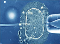 单一精子卵质内显微注射