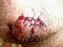 Thruster's chin injury