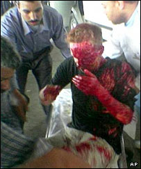 گردشگر اسرائيلی زخمی شده در انفجار در قاهره