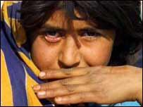 د يوې ماشومې التهابي سترګې