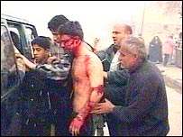 Muž zraněný po výbuchu v Bagdádu