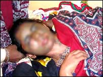 پاکستان میں تیزاب