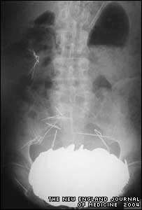 As moedas pesavam 5,5kg