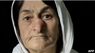 امرأة اصيبت بتشوه جراء الهجوم