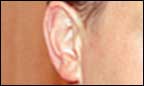 ear