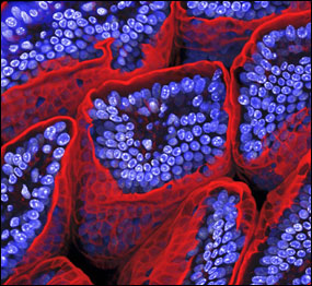 Intestino delgado (Foto: Paul Appleton/Wellcome Image Awards 2009)