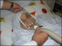 بيمار که مبتلا با مر يضی قلبی است