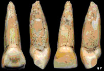 Dentes parecem com os do Neanderthal