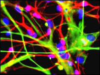 Kmenové buňky (ilustrační foto)