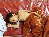 زلزلے سے متاثر بچہ