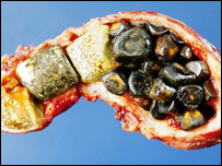 د تريخي تيږې