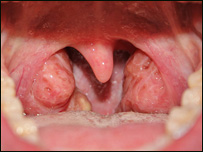 دتانسلونومکروبي کېدل