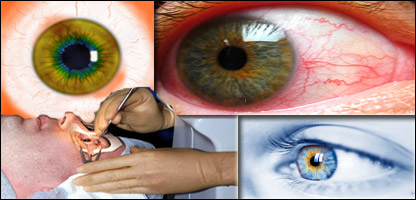 د سترګو د پردې د عمليات