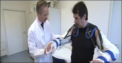 Paciente com braços transplantados