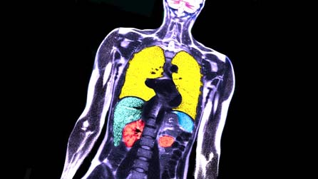 The inside of British athlete Jo Fenn's body. Image by Siemens