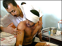 इराक़ में बम धमाके में घायल